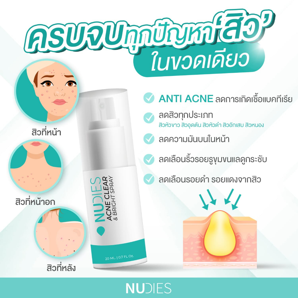 nudies-นู๊ดี้-สเปรย์ลดสิว-ลดสิวได้ทุกประเภท