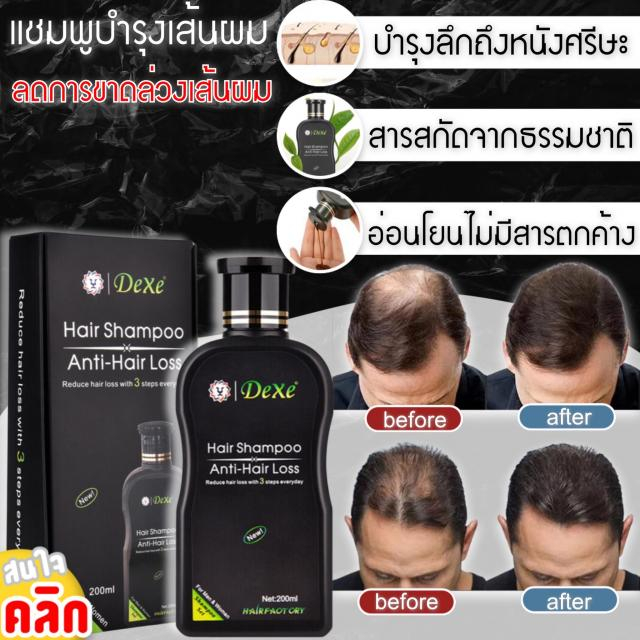 dexe-hair-shampoo-แชมพูบำรุงหนังศรีษะลดการ-ผมขาด-ผมร่วง-ผมบาง