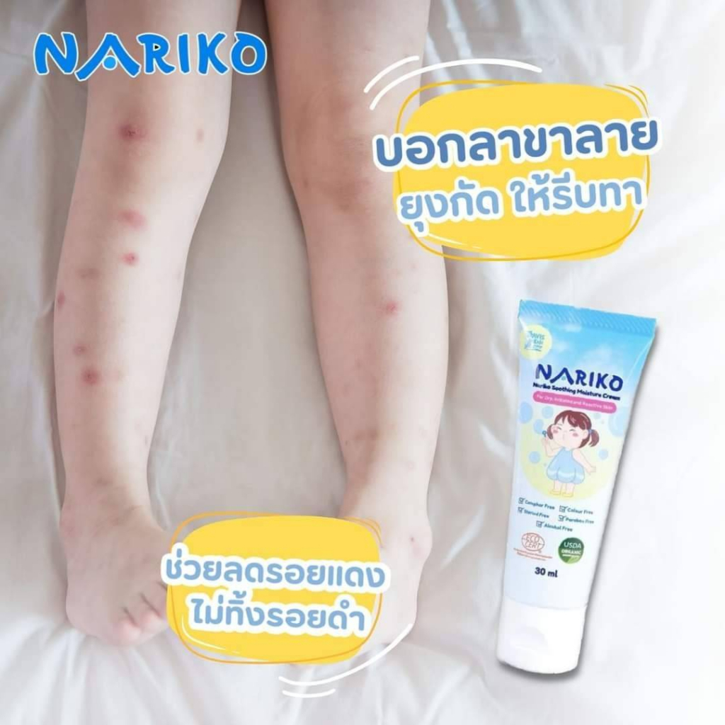 nariko-creamครีมบำรุงผิว-ลดผดผื่น