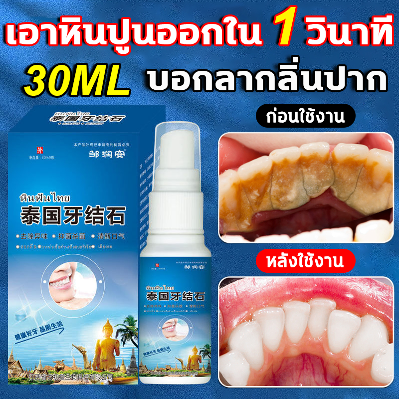 1วินาที-เพื่อขจัดหินปูน-น้ำยากำจัดหินปูน-30ml-ขจัดคราบหินปูน-น้ำยากำจัดหินปูน-กําจัดนิ่วในฟัน-ฟันขาวขึ้น-ขจัดหินปูนฟัน