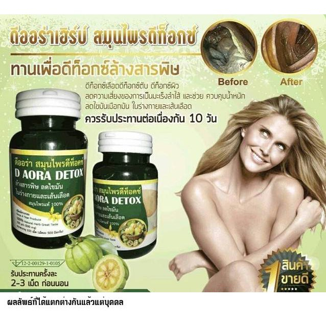 d-aora-herb-ดีออร่าเฮิร์บ-ผลิตภัณฑ์สมุนไพรดีท็อกซ์-ล้างสารพิษ-ลดไขมันในร่างกายเเละเส้นเลือด