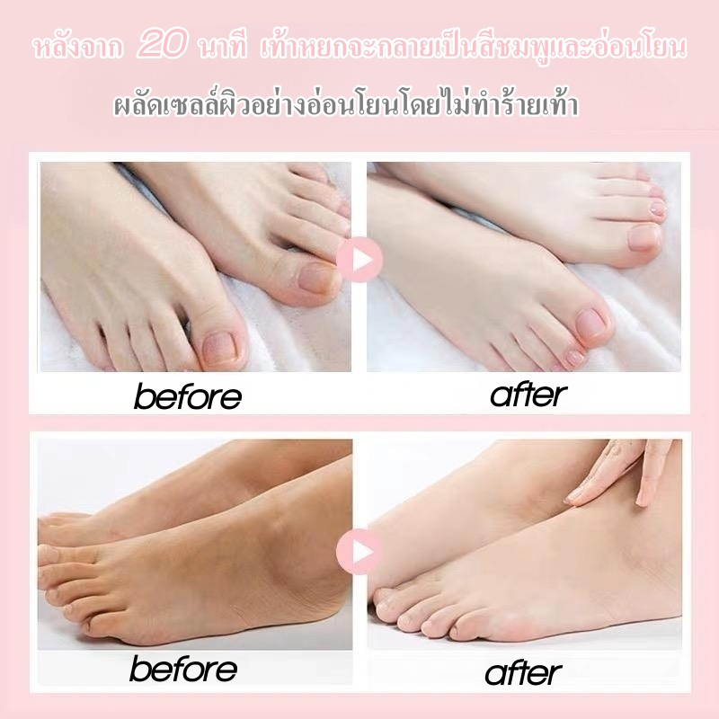 มาส์กลอกเท้า-vc-foot-mask-แก้ปัญหาเท้าด้าน-ปรับเท้านุ่มเหมือนเท้าเด็ก-ให้ความชุ่มชื้น