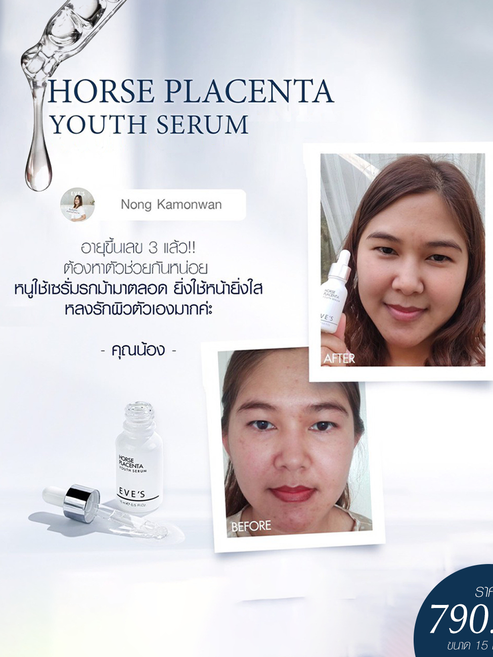 eves-เซรั่มรกม้า-เซรั่มอีฟส์-horse-placenta-youth-serum-เซรั่มลดรอยสิว-เซรั่มลดฝ้า-กระ-จุดด่างดำ-ผิวหน้าขาวกระจ่างใส