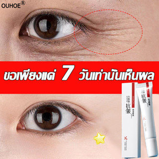 🔥7 วันเพื่อลบริ้วรอยรอบดวงตา🔥30ml ครีมลดถุงใต้ตา อายครีม ครีมทารอบดวงตา ครีมรอบดวงตา ครีมบำรุงใต้ตา ครีมบำรุงรอบดวงตา