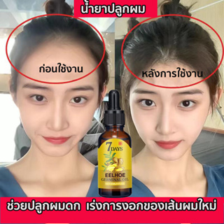 ของแท้100%！เซรั่มปลูกผม ปลูกผม น้ำยาเร่งผมยาว ป้องกันผมร่วง ทำให้รากผมแข็งแรงมากขึ้น เซรั่มปลูกหนวด ยาปลูกผมของแท้