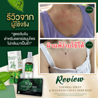 ส่งฟรี | กลากเกลื้อน สิวที่หลัง คราบดำ ขี้ไคล ขาหนีบดำ สบู่ว่านรางจืด สบู่สมุนไพร สะเก็ดเงิน โรคผิวหนัง เชื้อรา อาการคัน