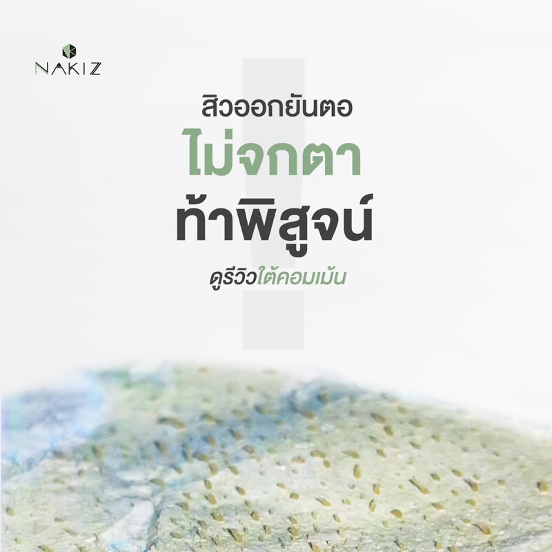 ครีมลอกสิวเสี้ยน-nakiz-lively-nose-ครีมลอกชาเขียว-หลุดยันราก-หมดปัญหาสิวเสี้ยน