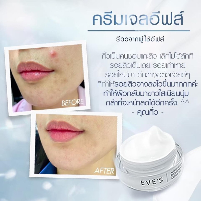 ครีมเจล-eves-20g-ผิวขาวกระจ่างใส-ลดเลือนฝ้า-กระ-จุดด่างดำ