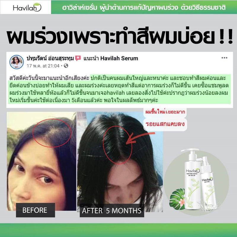 โทนิคปลูกผม100ml-แชมพูสมุนไพรสดแก้ผมร่วง-โทนิคปลูกผม-เร่งผมยาว-ฮาวิล่าห์shampoo