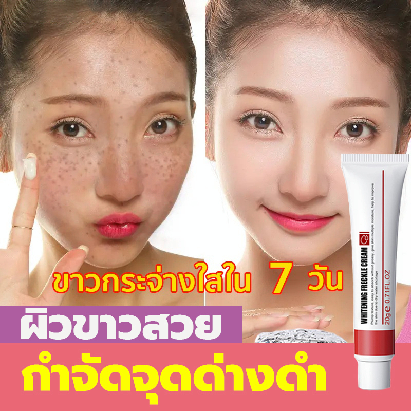 ครีมกําจัดฝ้า-eelhoe-20g-บอกลาปัญหากระ-ครีมทาฝ้า-จางลงฝ้ากระที่หนักได้-ลดเม็ดสีเมลานิน-กำจัดฝ้า-จุดด่างดำ-ฝ้า-กระ