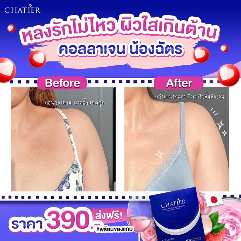 ชาเทียร์-คอลลาเจน-น้องฉัตร-chatier-premium-collagen