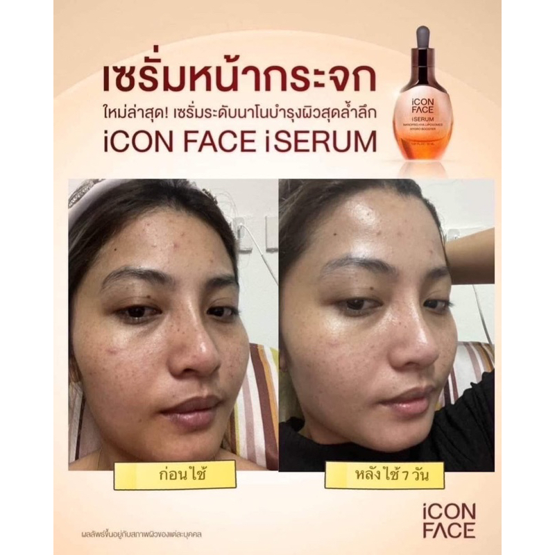 icon-face-iserum-เซรั่มหน้ากระจก-ของแท้-100