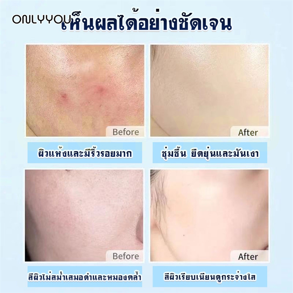 only-amp-you-แผ่นมาส์กหน้า-มาส์กหน้า-มาร์คหน้า-มาร์ค-mask-หน้าขาวใส-บำรุงผิว-ลดริ้วรอยมาร์คหน้า-หมองคล้ำ-หน้าใส-กระชับรูขุมขน-บำรุงผิว-ลดสิว-สตรูว่านหางจระเข้-vc