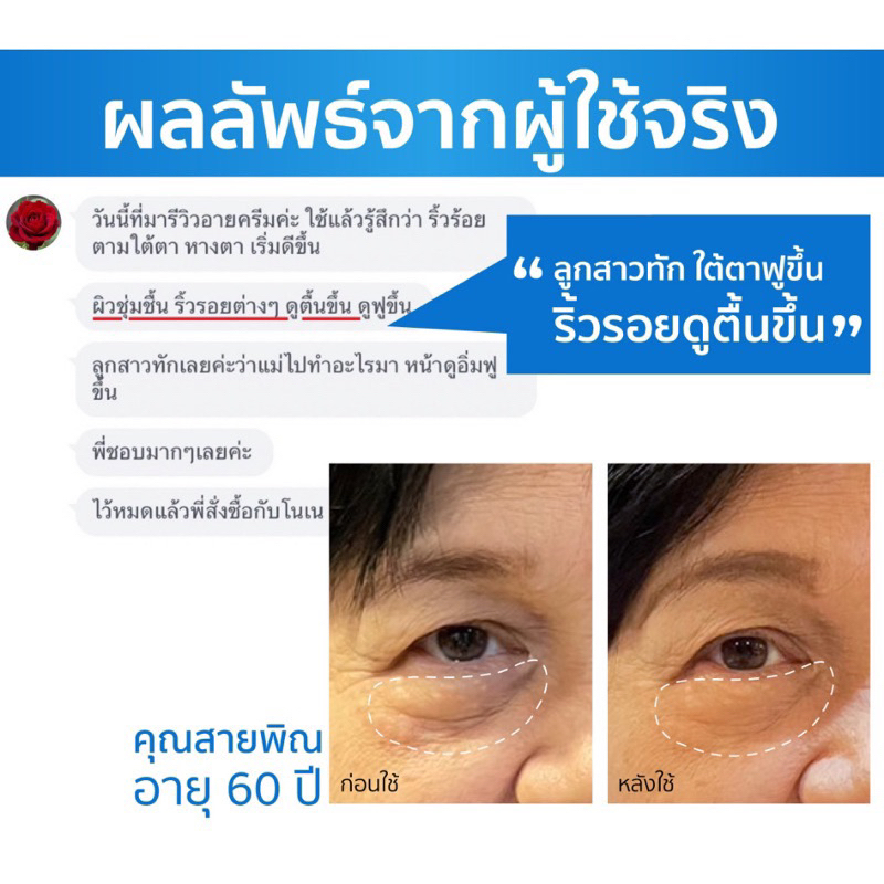 ส่งฟรี-ครีมบำรุงรอบดวงตาของ-ดร-จิว-15ml