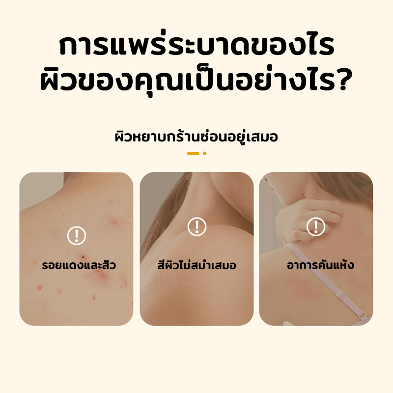 ครีมอาบน้ำกำจัดไร-ครีมอาบน้ํา-ครีมอาบน้ำลดสิว-300ml-ครีมอาบน้ำลดสิว-ขจัดไรและสิว-บอกลาผิวหยาบกร้าน-อ่อนโยนไม่ระคายเคือง