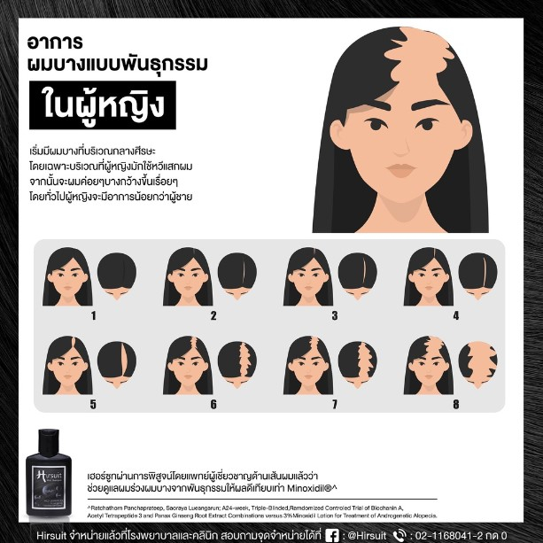 hirsuit-hair-tonic-เฮอร์ซูท-แฮร์-โทนิค-สเปรย์ลดผมร่วง-ปลูกผม-บำรุงเส้นผมและหนังศีรษะ-กระตุ้นการงอกผม