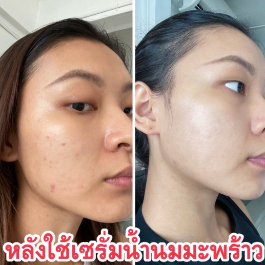 Coconice เซรั่มน้ำนมมะพร้าว หน้าขาว ลดสิว ลดฝ้า ลดกระ ลดจุดด่างดำ ลดรู ...