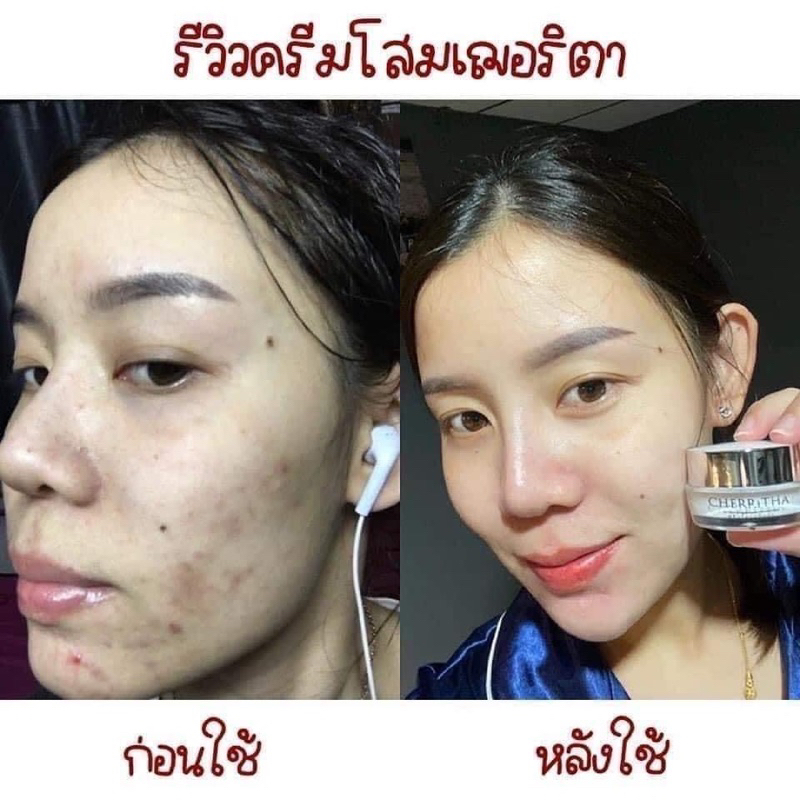 ครีมเฌอริตา-โสมเฌอริตา-ของแท้-พร้อมส่ง