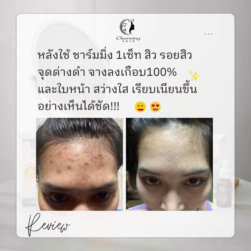 ชามมิ่งสกิน-charmingskin-ครีมลดฝ้า-ของแท้แบรนด์ไทย-มีอย-เช็คได้ค่ะ-แพ็คเก็จใหม่นะค่ะ