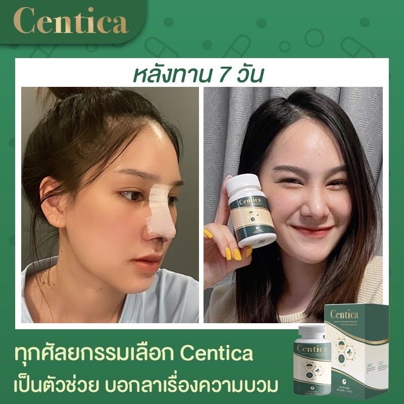 set-สายฉีด-หน้าเรียว-บำรุงผิว-และร้อยไหม-centica-ผลิตภัณฑ์อาหารเสริม-หลังศัลยกรรม