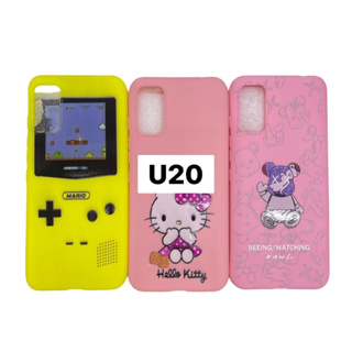 เคสสีพื้น ทึบ Wiko U10 U20 U30 ลายการ์ตูน ลายวินเทจ น่ารัก กันกระแทก เปิดลนส์กล้องหลัง พร้อมส่ง