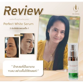 Perfact White serum เซรั่มสำหรับคนเป็นฝ้าใ้ช้ดูแลผิวเป็นฝ้าหน้าหมองคล้ำ