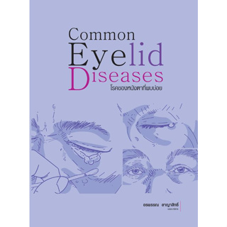 Chulabook(ศูนย์หนังสือจุฬาฯ) |c111หนังสือ 9786165653312 โรคของหนังตาที่พบบ่อย (COMMON EYELID DISEASES)