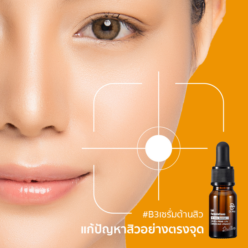 b3-acne-solution-แอคเน่-โซลูชั่น-ด็อกเตอร์เมย์-บีทรี-แอคเน่-โซลูชั่น