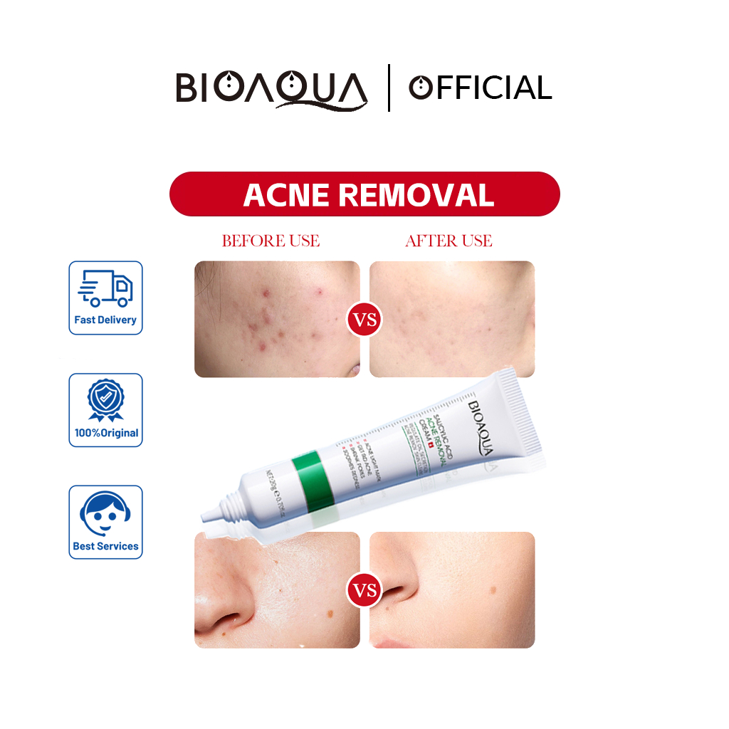 BIOAOUA Salicylic Acid Acne Removal Cream Shopee Thailand