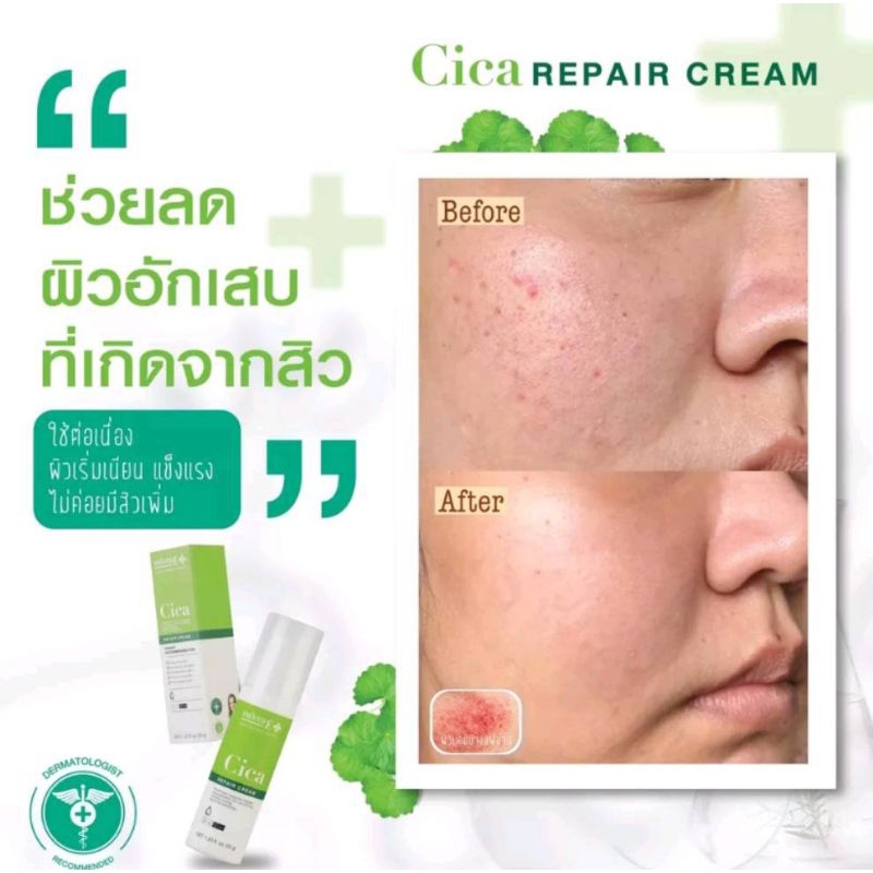 smooth-e-cica-repair-cream-สมูทอี-ซิกก้า-รีแพร์-ครีม-ครีมบำรุงผิวหน้า