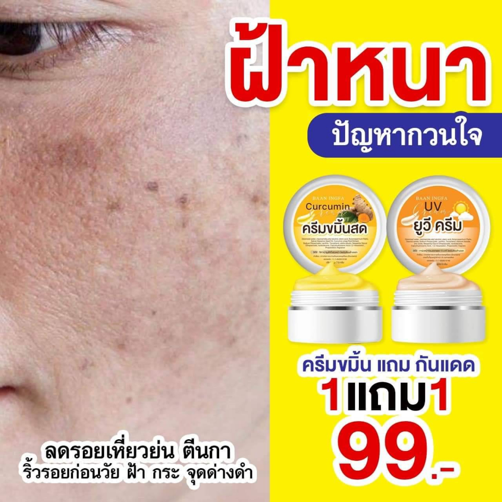 ขมิ้นอิงฟ้า-ซื้อ-1-แถม-1