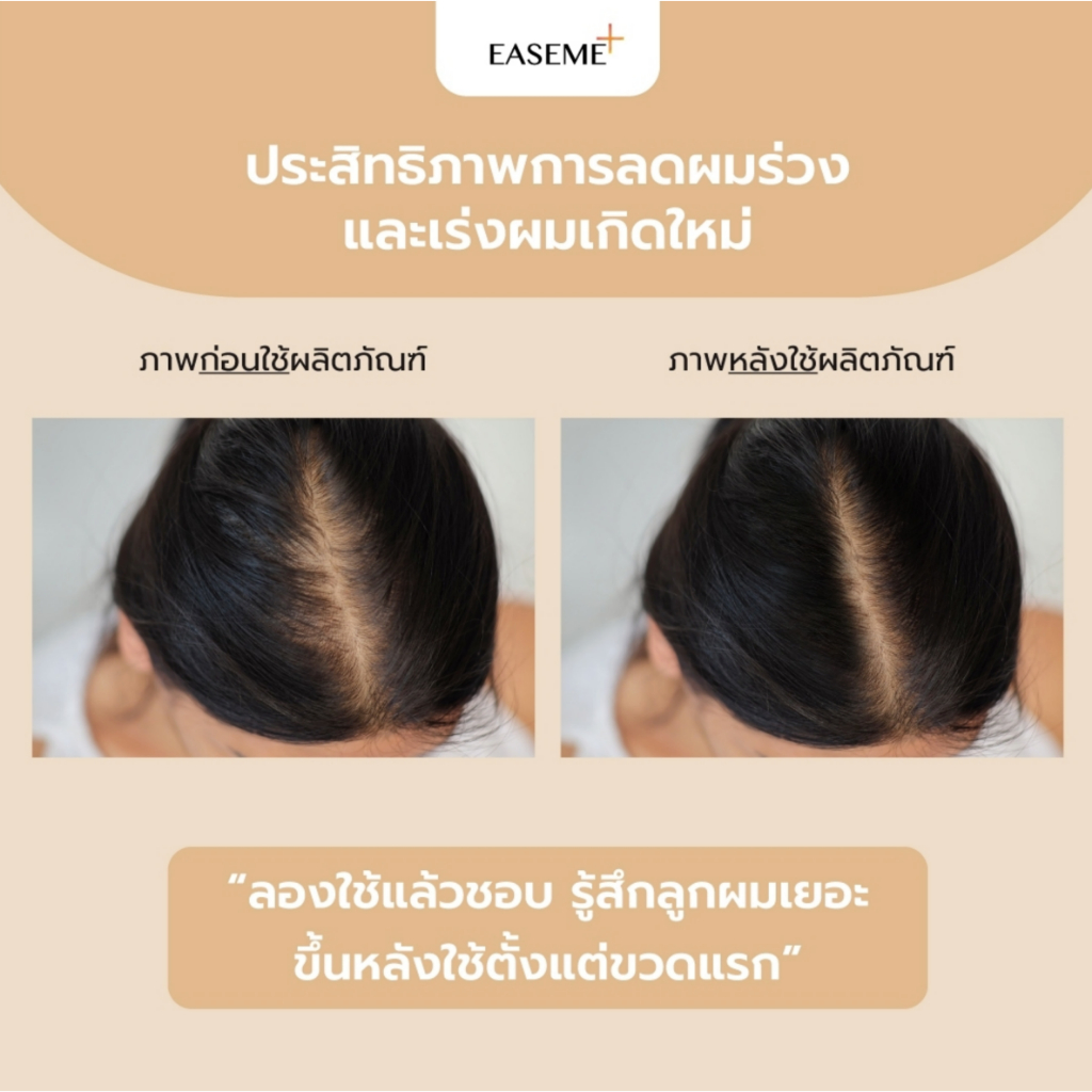 2ขวดราคาพิเศษ-แชมพู-2in1-สูตรเข้มข้น-หยุดทุกปัญหาผมในขั้นตอนเดียว