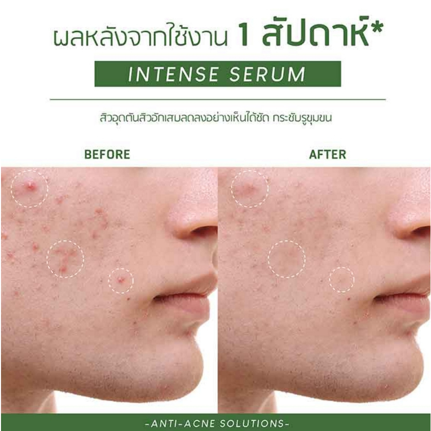 plantnery-เซรั่ม-tea-tree-intense-serum-30-มล