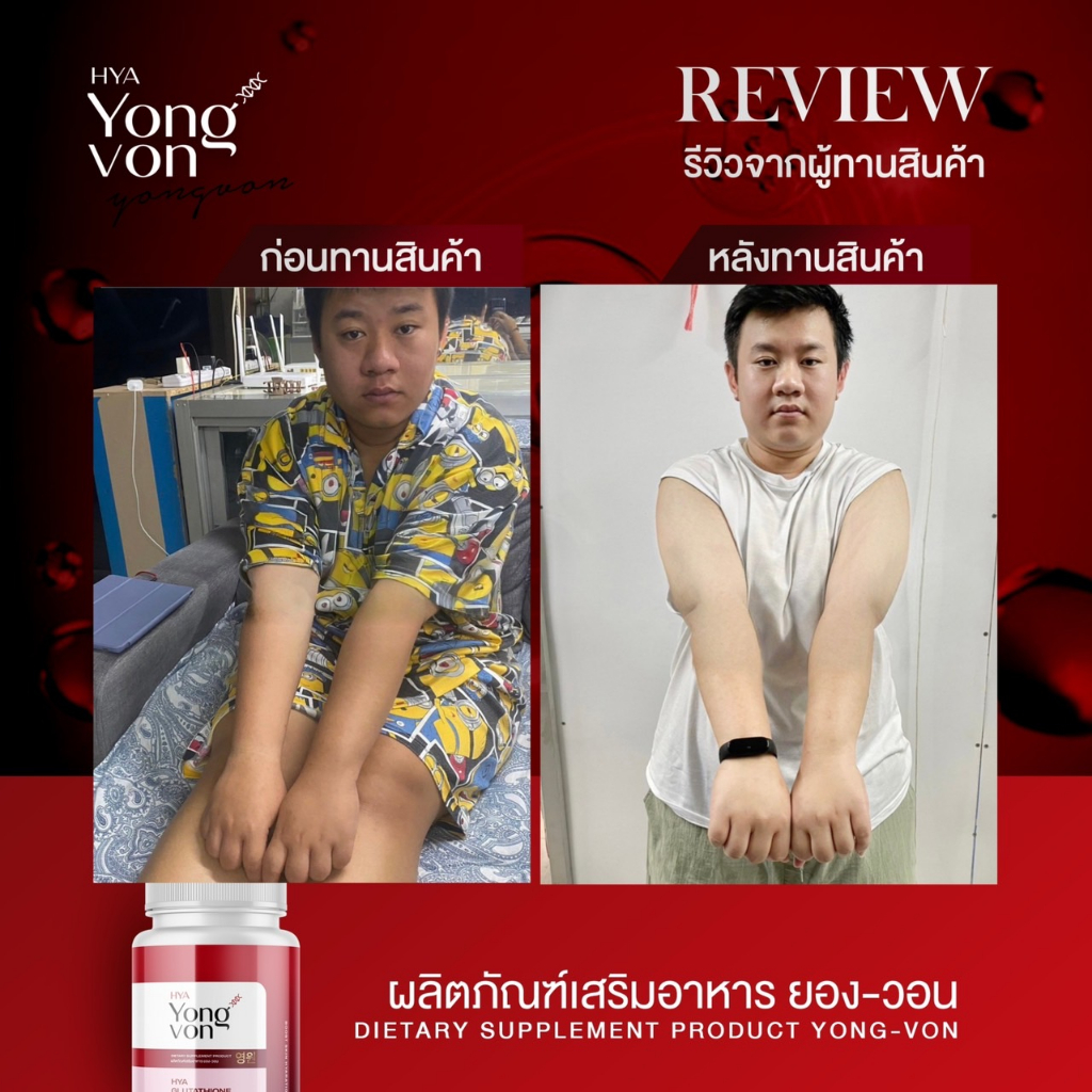 ส่งฟรี-1แถม-1-กลูต้ายิงวอน-yong-von-วิตามินผิวขาว-กลูต้า-ขาวใส-ผิวสวย-อาหารเสริม-ผิว