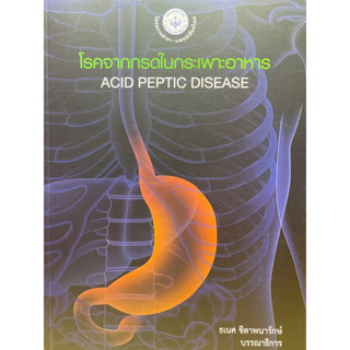 c1119786165884945 โรคจากกรดในกระเพาะอาหาร (ACID PEPTIC DESEASE)ธเนศ ชิตาพนารักษ์