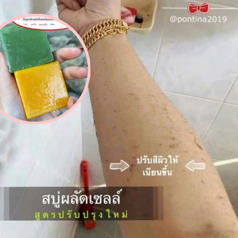 pontina-herbal-soap-สบู่สมุนไพรพรทิน่า-สบู่พรทิน่า-1-ห่อ-5-ก้อน-แถมถุงใส่สบู่ขัดผิว