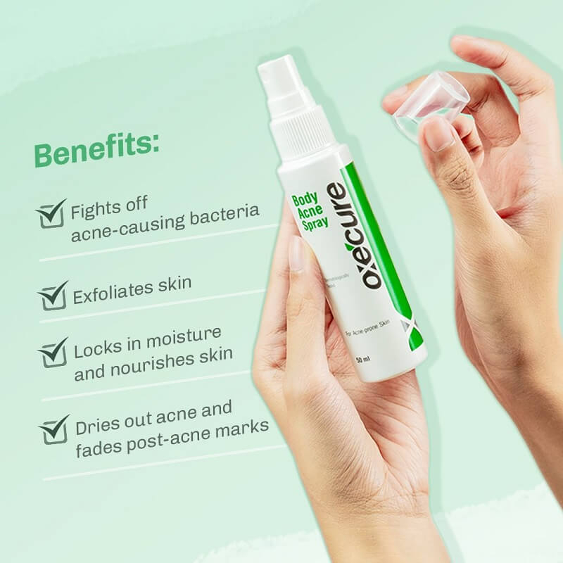 oxecure-body-acne-spray-50-ml-อ๊อกซีเคียว-บอดี้-สเปรย์-สเปรย์ลดสิว-สิวที่หลัง