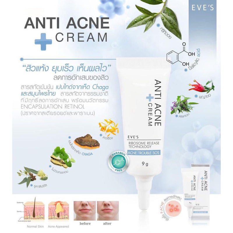 eves-anti-acne-cream-ครีมแต้มสิวอีฟส์-สิวยุบไว-สิวแห้งไว