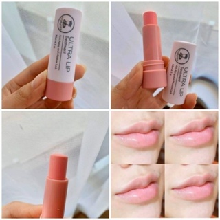 ลิปเภสัชกร Ultra lip treatment ลิปแก้ปากดำในตำนาน ทาแล้วปากชมพูทันที ชุ่มชื้นสุด ปากแห้งลอกคือหายวับ