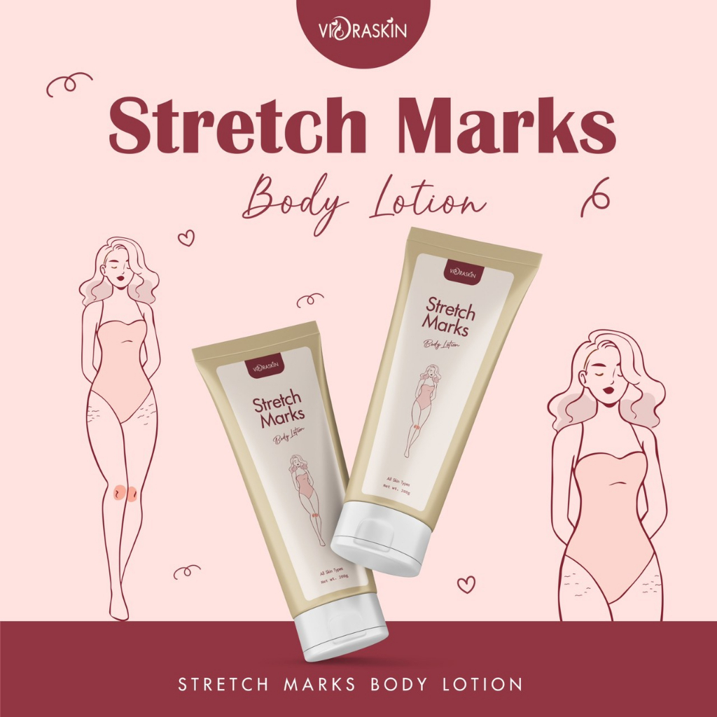 stretch-marks-body-lotion