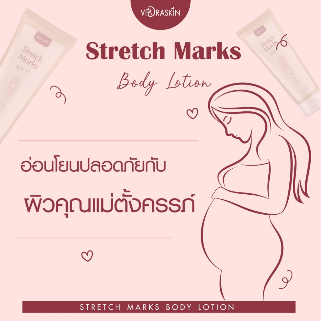 stretch-marks-body-lotion