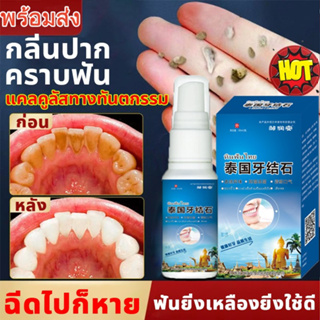 【เอาหินปูนออกใน 1 วินาที】น้ำยากำจัดหินปูน 30ML ขจัดคราบหินปูน กําจัดหินปูนฟัน ยาสีฟันฟอกฟันขาว Dental stone spray