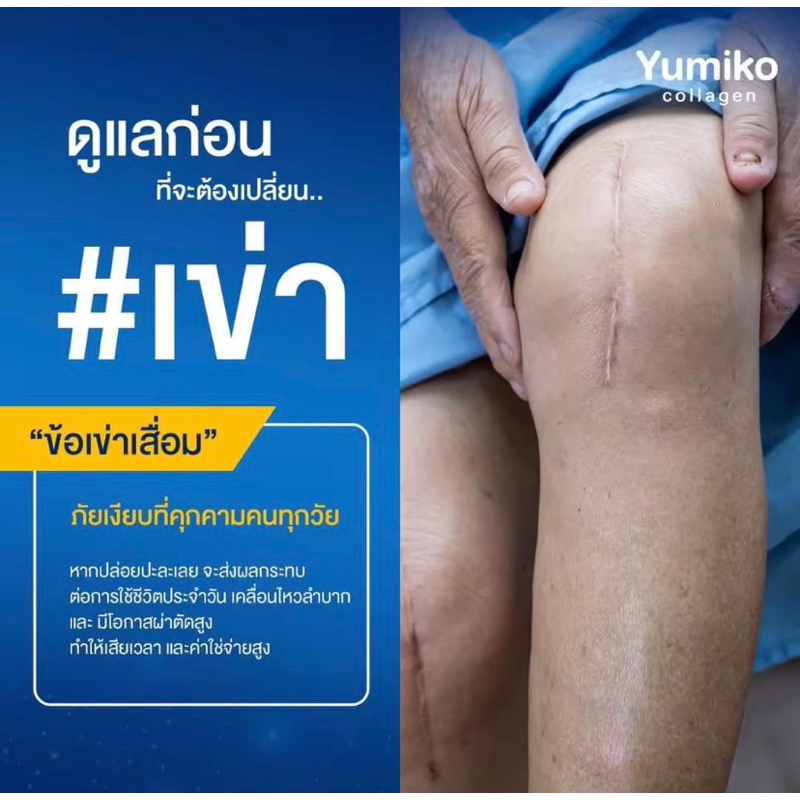 yumiko-colly-veggie-คอลลาเจนจากผัก-ยูมิโกะ-คอลลาเจน-พลัส-yumiko-collagen-plus