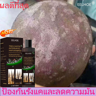 EELHOE100mlยาสระผมเชื้อรา แชมพูขจัดรังแค ป้องกันรังแคและลดความมัน ลดอาการคันศีรษะ ลดรังแค ลดสิวsea salt shampoo