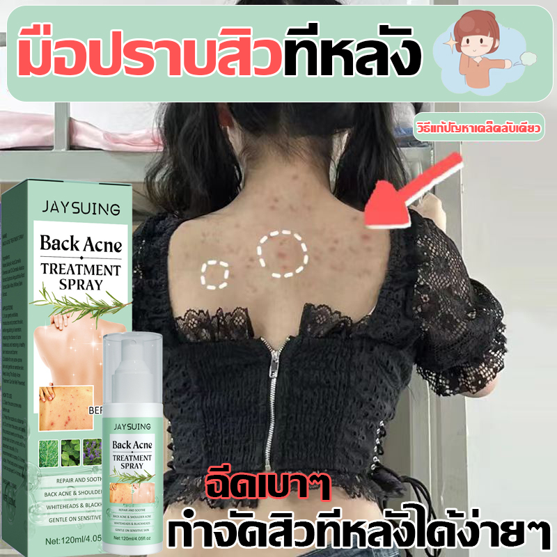 กําจัดสิวได้อย่างรวดเร็วโดยไม่ทิ้งร่องรอย-jaysuing-สเปรย์รักษาสิวที่หลัง-สิวหน้าอก-สิวใบหน้า-สูตรแพทย์แผนไทย