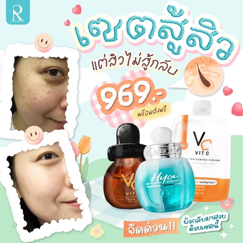 เซรั่มไฮยา-เซรั่มวิตซี-เซตขายดี