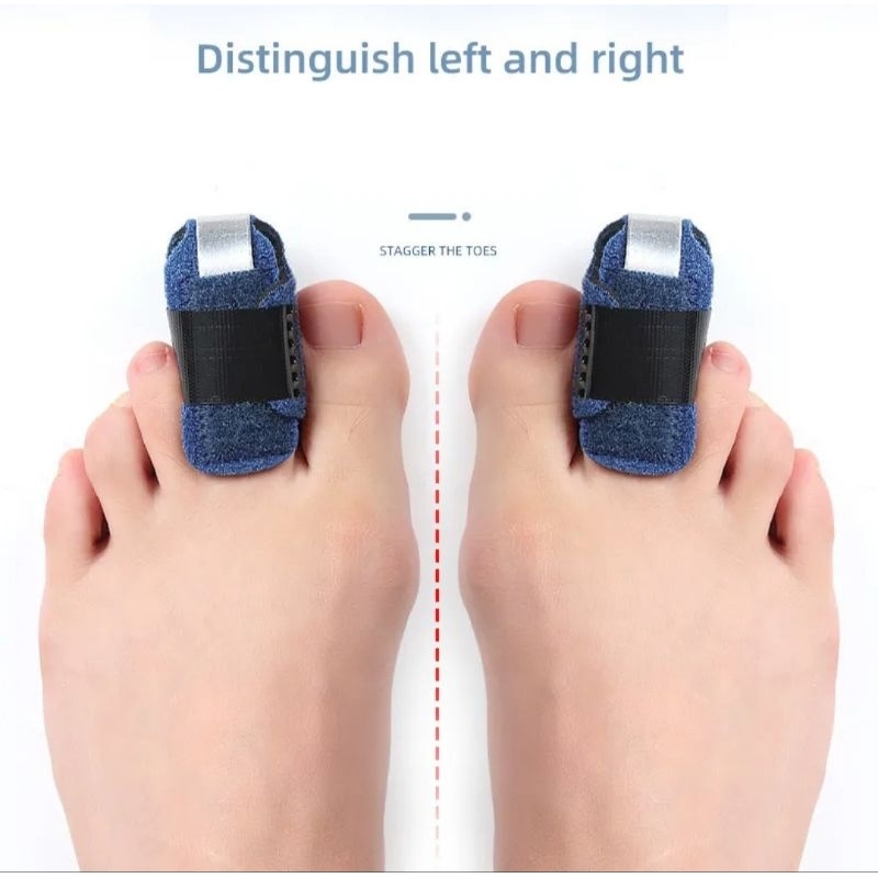ดามนิ้วเท้า-toe-splint-เฝือกอ่อนดามนิ้วเท้า-ราคาต่อ1ชิ้น-เสริม-แกนแข็งอลูมิเนียม-สำหรับดามนิ้วเท้า-ป้องกันลดการงอข้อนิ้ว