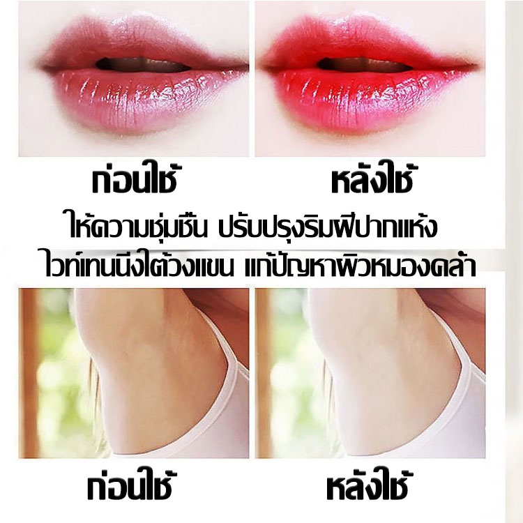 caiqingจัดส่งแบบลับ-บำรุงน้องสาว-10ml-ครีมจักแร้ขาว-บำรุงจุดซ่อนเร้น-ครีมหัวนมชมพู-ลิปแก้ปากดํา-ครีมทาจิ๋มชมพู-ยาทาหัวนม