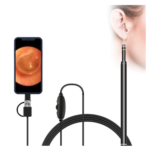 ไม้แคะหูกล้องส่องตรวจหู-ear-wax-removal-endoscope-ที่ทำความสะอาดหูกล้อง-endoscope