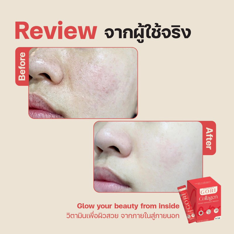 gori-collagen-โกริคอลลาเจน-เพื่อผิวกระจ่างใส-ผมเล็บ-วิตามินผิวใส-ลดสิว-1-กล่องมี-7-ซอง